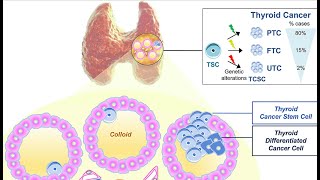 Non neoplastic diseases of the thyroid gland pathology quick recap by ASM Minds Team [upl. by Anayhd]