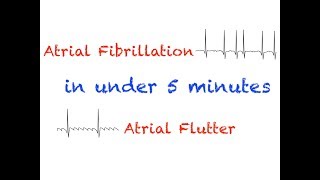 AFib and AFlutter Interpretation Under 5 minutes [upl. by Matuag]