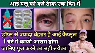 Chloramphenicol eye ointment eye capsule से करें आई फ्लू को करें ठीक [upl. by Aniratak]