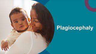 Plagiocephaly Positioning for your baby [upl. by Velleman]