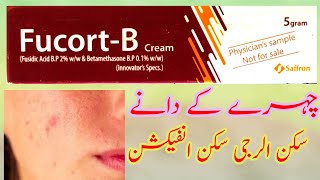 Fucort B cream ueses in urdu hindi  fusidic acid sideffects 2024 Healthcaremedicalinfo [upl. by Nathaniel]