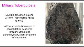 GROSS PATHOLOGY OF MILIARY TUBERCULOSIS [upl. by Belle366]