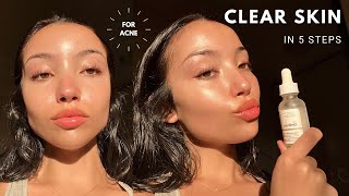 MY UPDATED SKINCARE ROUTINE  unsponsored skincare for acne [upl. by Ninon146]