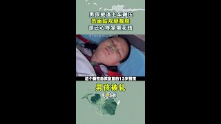 男孩被渣土车碾压，恐面临双腿截肢，却还心疼家里花钱！ 急救 截肢 社会百态 纪录片 催泪 [upl. by Cart]