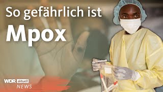 Mpox WHO ruft weltweite Notlage aus  WDR Aktuelle Stunde [upl. by Ymrots]