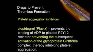 Platelet Aggregation Inhibitors [upl. by Annola402]