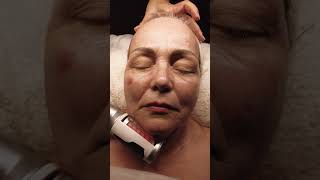 🟢 Skin Care ASMR Facial Hydrafacial 💚 estheticianlife skincareasmr skincaretips [upl. by Peace]