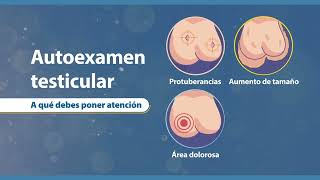 Cáncer testicular [upl. by Annoyed]