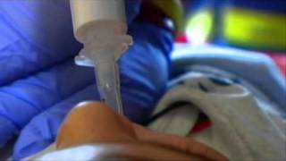 Intraosseous Cannulation IO video CME [upl. by Asserak625]