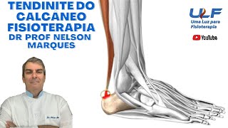 Tendinite do Calcâneo  Fisioterapia  Dr Prof Nelson Marques [upl. by Avraham375]