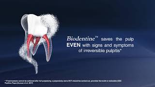 Biodentine  REVERSE THE IRREVERSIBLE [upl. by Kavanaugh]