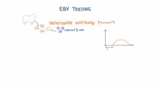 Epstein Barr Virus EBV Diagnosis and Testing [upl. by Arved203]