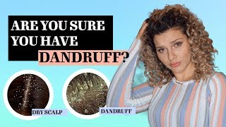 THE DIFFERENCE BETWEEN DANDRUFF VS DRY SCALP  TREATMENTS [upl. by Garrot]