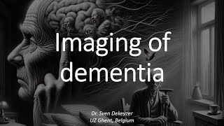 When is it dementia Imaging in dementia from Alzheimer to CreutZfeldtJakob [upl. by Ahsitra160]