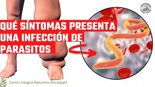 Síntomas de una infección por parásitos intestinales Shorts [upl. by Otilopih]