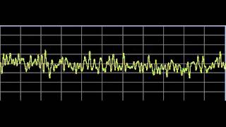 Metabolism Repair  Rife Frequencies [upl. by Mirelle]