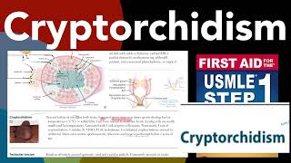 Cryptorchidism in HindiUrdu by first aid for USMLE step 1 [upl. by Zane]