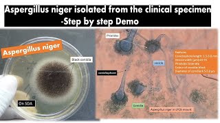 Aspergillus niger Isolation from clinical sapmle Steps [upl. by Yot515]