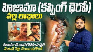 హిజామా వల్ల అద్భుతమైన లాభాలు  benefits of Hijama or Cupping Therapy  Ask Imran Ali [upl. by Naghem]