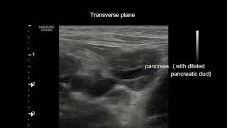 Extrahepatic cholestasis in a cat [upl. by Acilejna]