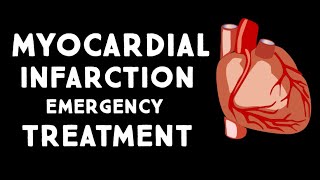 Myocardial Infarction MIHeart Attack Treatment in Emergency  Step wise STEMI Management USMLE [upl. by Otnas957]