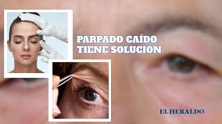 CódigoSalud  Párpado caído ¿Qué es en qué consiste la cirugía y cuánto cuesta [upl. by Petula490]