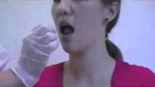 Orofacial Myology Exercises Neon Exercise Elasticswmv [upl. by Bremser]