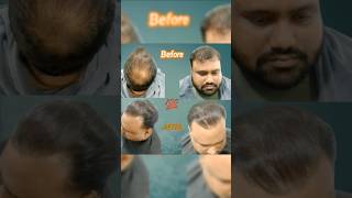 Keratin treatmenthairstyle newlook haircut shorts style entertainment 👍💆 music [upl. by Rik719]