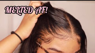 How to RE Install Frontal Wigs for Beginners  VERY DETAILED  Melt Transparent Lace [upl. by Martineau878]