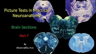 Picture Test in Neuroanatomy Brain Sections 7 [upl. by Gapin]