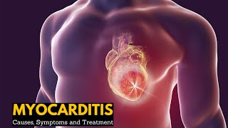 Myocarditis Causes Signs and Symptoms Diagnosis Treatment [upl. by Ingelbert764]