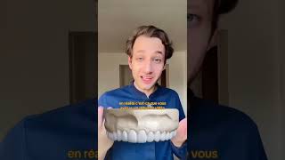 SIMULATION DES FACETTES DENTAIRES  🦷 dentiste facettes dentsblanches [upl. by Notniw]