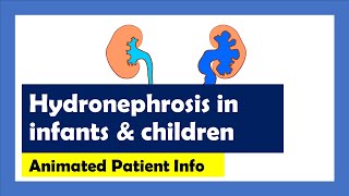 Hydronephrosis Explained Animated Patient Info [upl. by Sowell]