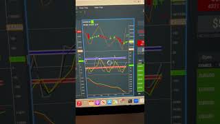 Trade of the Day  Oct 18 investing daytrading wealth money education trading workfromhome [upl. by Niatsirt]