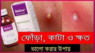 Treatment Of Boils  ফোঁড়া হলে করনীয়  Skilox 500 Phylopen Fluclox Flubex Flucloxacillin500 [upl. by Capp]