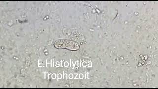 Trophozoite of Entamoeba histolytica [upl. by Alag]