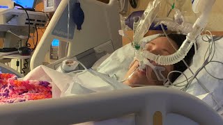 Waukesha woman placed in medically induced coma warns against vaping [upl. by Sama]