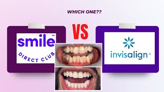 Smile Direct Club VS Invisalign  My Bad Experience [upl. by Coretta]