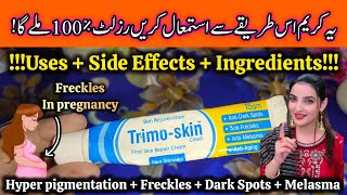 Trimo Skin cream Review  How to use trimo skin cream  Hyperpigmentation melasma freckles Cream [upl. by Abernon]