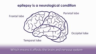 What is epilepsy  Epilepsy Society [upl. by Eceinart50]