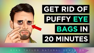 Get RID of Puffy Eyes Instantly Natural Remedies [upl. by Galvin777]