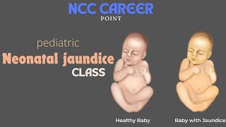 Pediatric Neonatal Jaundice class  2024 [upl. by Etteve221]