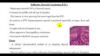 Follicular Thyroid Carcinoma FTC [upl. by Assilym]