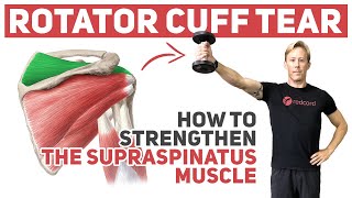 Rotator Cuff Tear How to Strengthen Supraspinatus [upl. by Prudi]