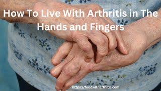 How to Live With Arthritis in The Hands and Fingers [upl. by Iren]