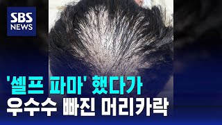 셀프 파마 했다가…우수수 빠진 머리카락  SBS [upl. by Omoj]