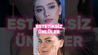 Estetiği Olmayan Ünlüler neslihanatagül aslıenver [upl. by Hecht]