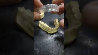 How we make dental PROTECTION bro [upl. by Jadda]