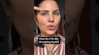 How Do I Fix My Droopy Eyelid botoxinjections dermalfillers educational facialaesthetics [upl. by Enerol]