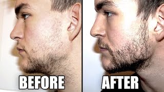 Trying a Beard Growth Kit for 2 Months  My RESULTS  CPH Grooming Review [upl. by Asiled525]